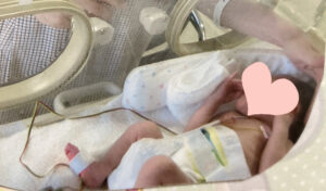NICUに入院中の双子の赤ちゃん